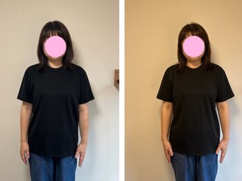 シゼン(Shizen)/ビフォーアフター