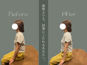 スクエア整体院(Square整体院)/猫背に対するアプローチ
