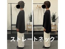 カワル整体 長嶺院/ストレートネック