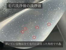 ダリア(Dahlia)/スキンケアの浸透力UP！