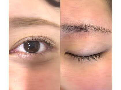 ラソ(Lazo)の写真