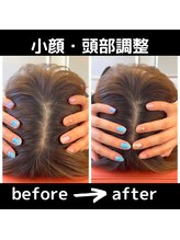 えにし鍼灸院 整体院/頭蓋骨調整