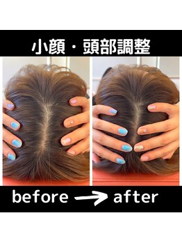 えにし鍼灸院 整体院/頭蓋骨調整