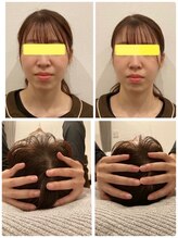 千種くま整体院/☆小顔矯正☆