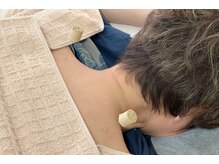 命水鍼灸院/肩こり【新宿/鍼灸】