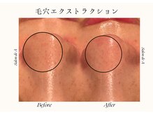 サロンドエー 帝塚山(Salon de A)/黒いポツポツがあったら…