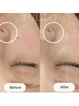 プリドー(PULIDO)/PULIDO式肌育メソッド