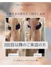 【贅肉撃退!】1台5役の最新セルラジ2回目以降～★全身¥11000