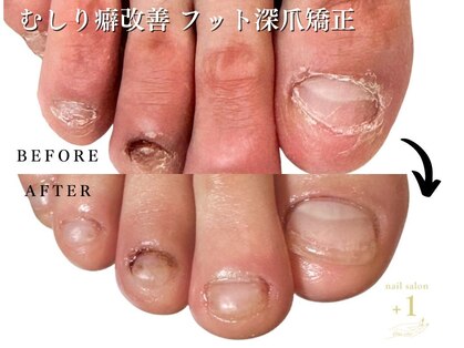 プラスワン(+1)の写真