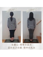 りもあず(ReMore-S)/写真写りで顔の左右差が気になる