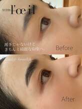 ロイ 箕面桜井(l'oeil)/lashlift+browlift