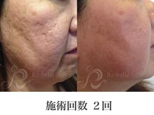 パルファンカルム 駅西本町店/エイジングケアにも効果抜群！