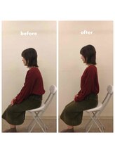 みらい整骨院/デスクワークで猫背の方おススメ