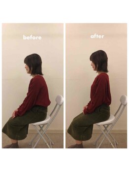 みらい整骨院/デスクワークで猫背の方おススメ