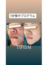 ソリッジ肌管理室/TIPハーブピーリング