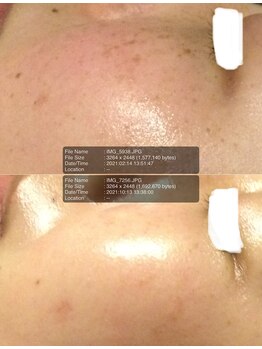 ブリエールラミール/シミケア