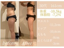 ラ コンシェル 溝の口店/●Before After●【溝の口】