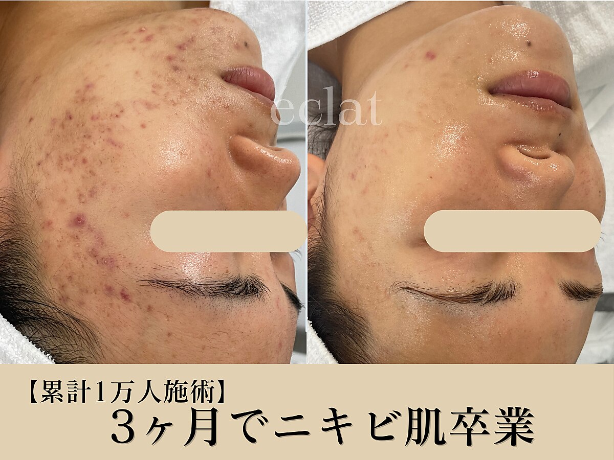エクラ(eclat)｜ホットペッパービューティー