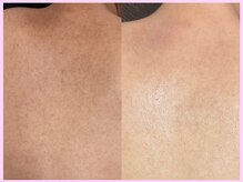 マヤヒメ(mayahime)の雰囲気（お背中も大人気のREVIハーブピーリングオプション揃ってます）