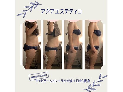 アクア エステティコ 亀有(ACQUA estetico)の写真