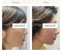 KANコルギセラピー 福井店