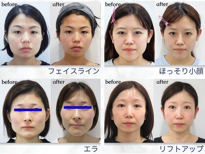 美デザイン 梅田駅前店(美.design)の写真