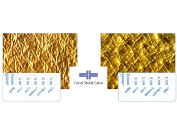 フェイシャルスタイリストサロン 高崎店(Facial Stylist Salon)/キメのケア例(17)