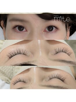 ミテ(mite.)/140本イメージ