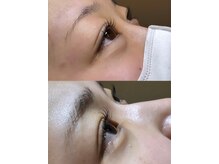 ユニバー(UNIVER)