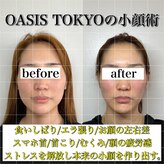ネオオアシス トウキョウ 本町(ネオOASIS TOKYO)