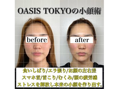 ネオオアシス トウキョウ 本町(ネオOASIS TOKYO)の写真