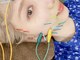 恵比寿すこやか鍼灸整骨院の写真/【恵比寿駅徒歩2分♪】フェイシャルケアに美容鍼は試しましたか？小顔・ほうれい線・たるみ改善に◎
