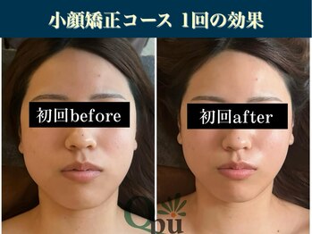 キュープ 表参道店(Qpu)/継続が「小顔」と「美」をつくる