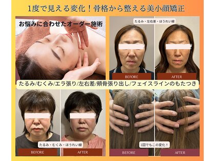 小顔×肌質ケア&経絡ヒーリングKimusubi の写真