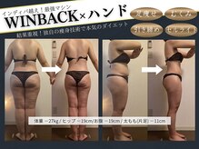 エソール(essor)の雰囲気（ラジオ波で本格痩身！限定クーポン有☆痩身/ダイエット/リンパ）