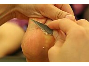 満足/角質を丁寧に取り除き　すべすべ