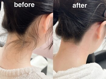 ネリネ 博多(nerine)/うなじワックス脱毛[博多駅]