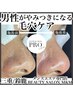 男性限定！毛穴汚れ徹底解消！人気NO1！毛穴改善コース ¥13000→¥10400