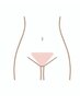 女性デリケートゾーン　ビキニライン(Vライン)脱毛１回