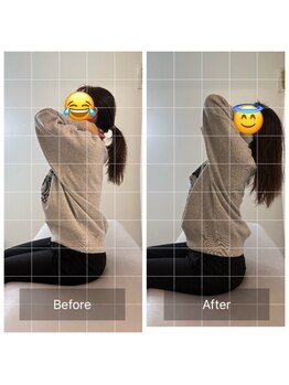 ナオル整体 恵比寿院(NAORU整体)/恵比寿/整体事例【首肩コリ】