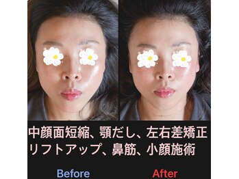 美容矯正サロン レレポノ(LELEPONO)/