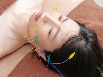 イベリア 心斎橋店(IBERIA)/美容鍼