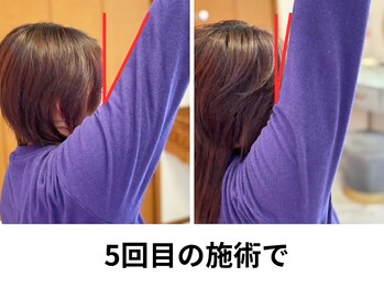 パーソナル整体 チェンジ(CHANGE)/Before After