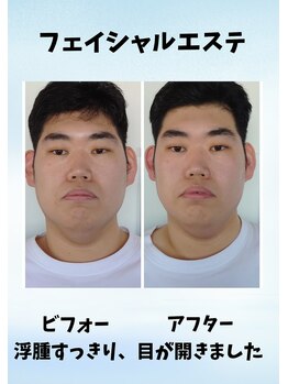 ちゅらゆき/美容カイロ