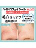 【3/17～22限定クーポン☆】花粉対策にも！ハイドロ毛穴洗浄8,800円→4,500円