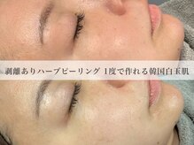 カヌヌ(kanunu)の雰囲気（ハーブピーリングでは一度の施術でここまでの透明感が可能◎）