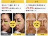 遂に日本上陸!韓国クリニック開発Gpeel!シミ.しわ.色沈.老化肌!敏感肌◎