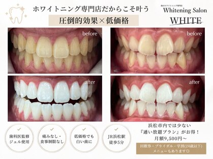 ホワイト(WHITE)の写真