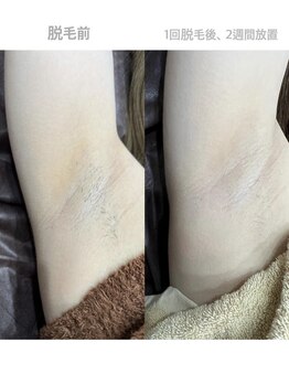 ルトゥール(Retour)/レディース ワキ