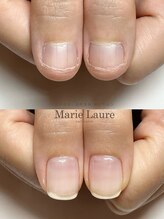 マリーロール 淀屋橋本店(Marie Laure)/自爪育成/深爪矯正/ネイルケア